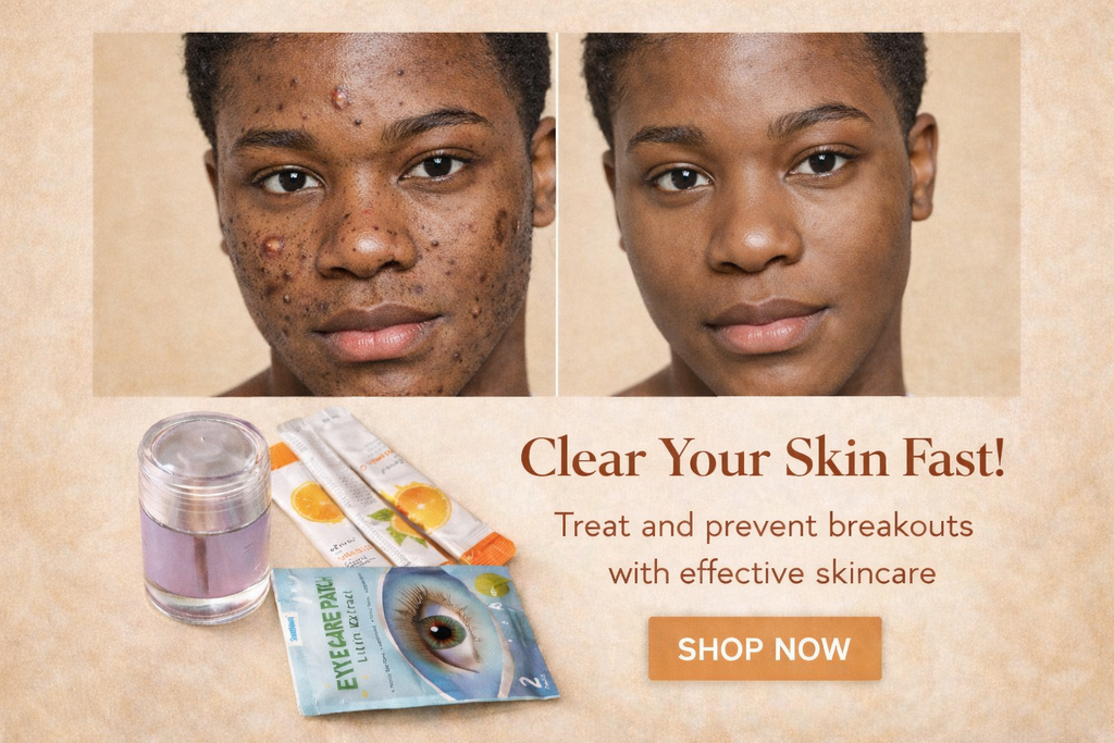 Kit composé (de 5 produits)kit anti taches boutons ,cernes,pores dilatés et boutons trés efficace et sans effet secondaire livraison gratuite