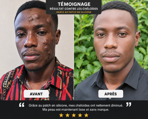 Patch en silliconne éliminant les cicatrice (ancienne recente) , cheloïde, vergetures résultats rapide livraison gratuite partout