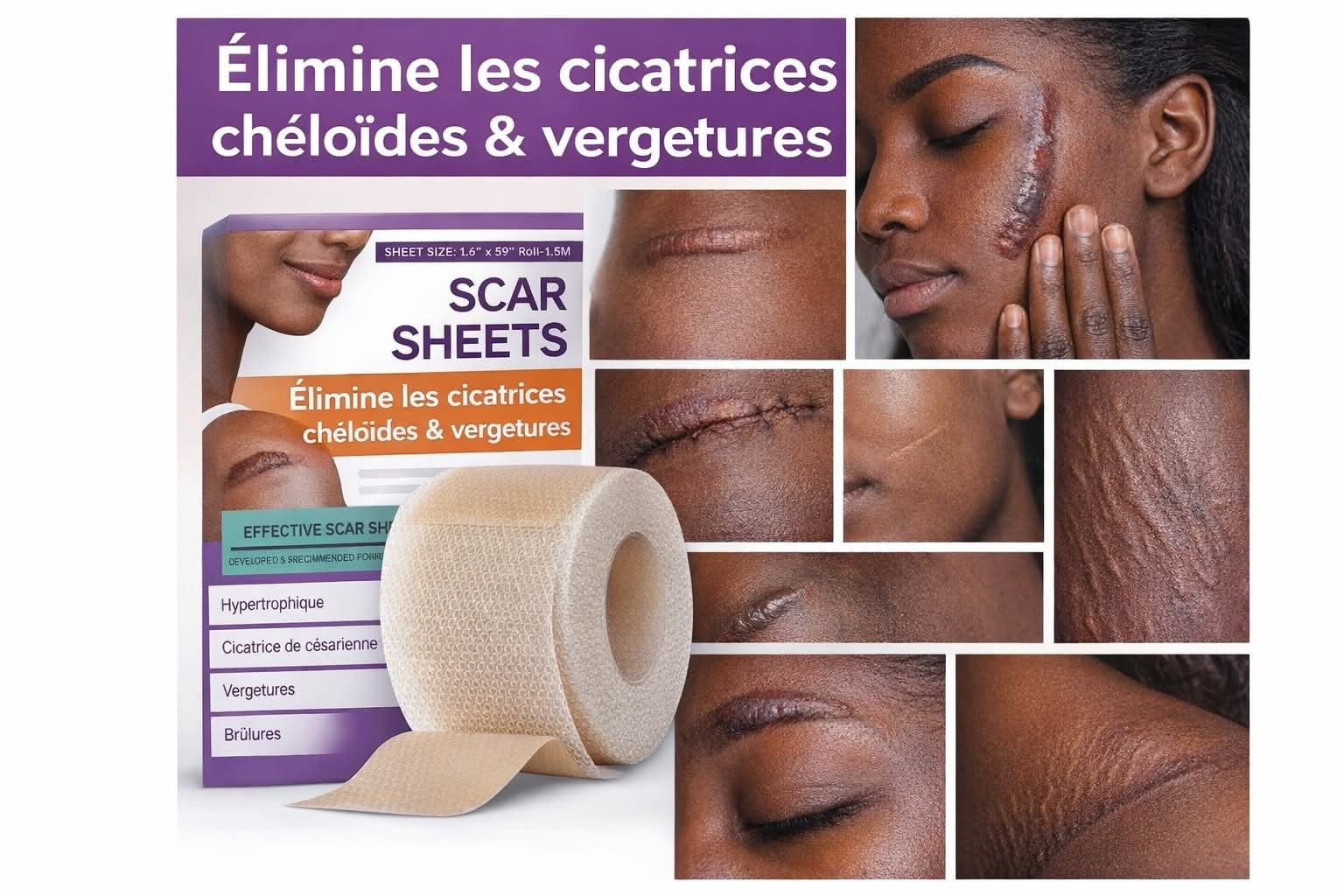 Patch en silliconne éliminant les cicatrice (ancienne recente) , cheloïde, vergetures résultats rapide livraison gratuite partout